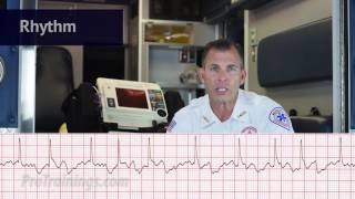 Atrial Fibrillation ECG Rhythm Interpretation [upl. by Aoket]