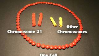 Nondisjunction Trisomy 21  An Animated Tutorial [upl. by Adolph594]