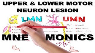 Upper amp Lower Motor Neuron Lesions  Mnemonic series 5 [upl. by Anomis]