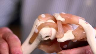 Treating Stiff Joints [upl. by Kenyon]