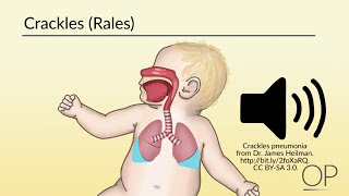 Respiratory Assessment by B Leary L DelSignore  OPENPediatrics [upl. by Josephson]