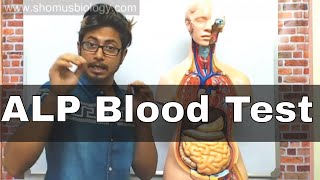 ALP blood Test in Hindi alkaline phosphatase test [upl. by Esiouqrut620]