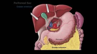 Peritoneum tutorial [upl. by Eilrak]