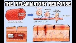 THE INFLAMMATORY RESPONSE [upl. by Otiragram]