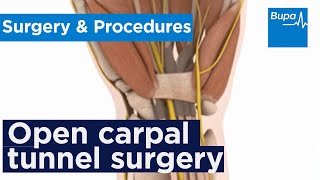 Hand Surgery Procedures [upl. by Boone223]