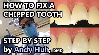 How to fix a chippedbroken tooth dental bonding composite Pasta Evergreen Dental Billerica MA [upl. by Otrebmuh12]