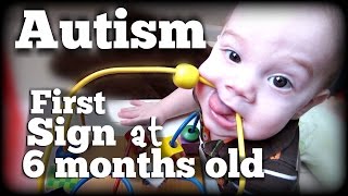 AUTISM First Sign at 6 months old [upl. by Ledif]