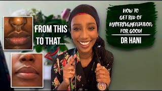 How To Get Rid Of Hyperpigmentation  Dr Hani [upl. by Udenihc796]