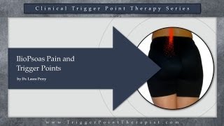 IlioPsoas Pain and Trigger Points [upl. by Atwahs81]