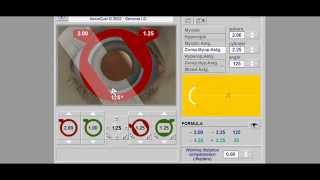 Retinoscopy Simulator Tutorial  Retinoscopy part 2 [upl. by Desta76]