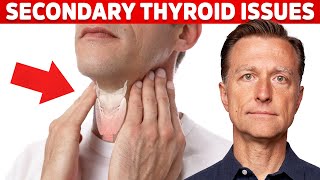 Most Thyroid Issues Are Secondary to Other Problems – Dr Berg [upl. by Eigriv]