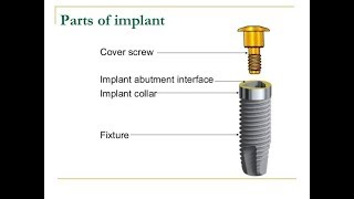 PARTS OF DENTAL IMPLANT [upl. by Asirralc]