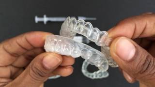 How to use Tooth Whitening Trays [upl. by Anelrac699]