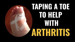 Taping a toe to help with arthritis  Dr Donald Pelto  Worcester Massachusetts [upl. by Moon]