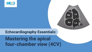 Echocardiography Essentials Mastering the apical fourchamber view 4CV [upl. by Nedarb]