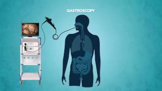 Gastrocopy [upl. by Fogg]