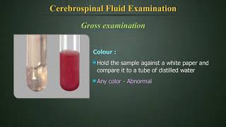 Cerebrospinal Fluid Examination CSF [upl. by Ayat]