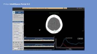 Philips IntelliSpace Portal 90 clinical application CT Brain Perfusion [upl. by Sparrow]