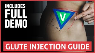 All You Need To Know About Joint Injections [upl. by Sadnak377]