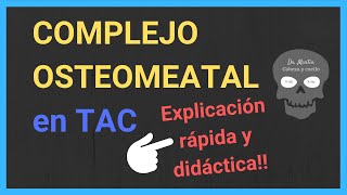 COMPLEJO OSTEOMEATAL ➡️ TAC [upl. by Birck]