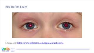 Pediatric Eye Exam [upl. by Ripleigh]