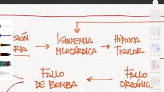 Medicina de urgencias Shock cardiogénico [upl. by Aleahc]