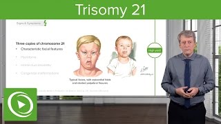 Trisomy 21 Down Syndrome Introduction – Pediatrics  Lecturio [upl. by Akerdna]