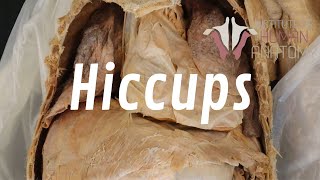 What Are Hiccups and Why Do We Get Them [upl. by Nawk]