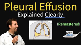 Pleural Effusions  Causes Diagnosis Symptoms Treatment [upl. by Leopoldeen]