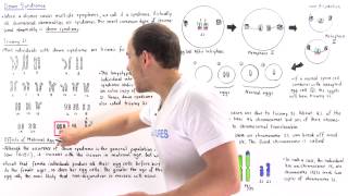 Down Syndrome Trisomy 21 and Translocation [upl. by Anytsyrk]