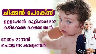 Day in the Life  Baby with Chicken Pox [upl. by Betsey]