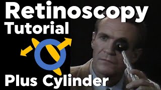 Retinoscopy Plus Cylinder Full Tutorial with Phoropter [upl. by Lasiaf]