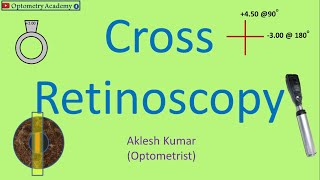 Cross Retinoscopy  Retinoscopy Procedure [upl. by Given]