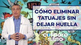 ¿Existe alguna técnica para eliminar tatuajes sin dejar huella [upl. by Munroe]