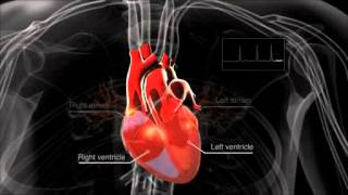 What is atrial fibrillation [upl. by Akienahs]