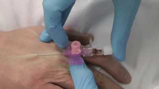 Advanced Clinical Skills Arterial Line Insertion [upl. by Langill172]