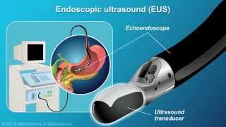 Understanding EUSFNA [upl. by Ellekcim438]