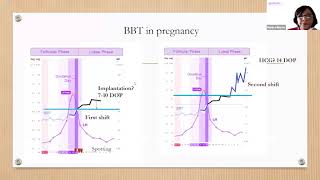 Tracking Your Basal Body Temperature  BBT Basics with Monica NFP Instructor [upl. by Yahsel]