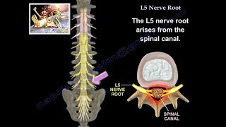 L5 Nerve Root  Everything You Need To Know  Dr Nabil Ebraheim [upl. by Yggam]