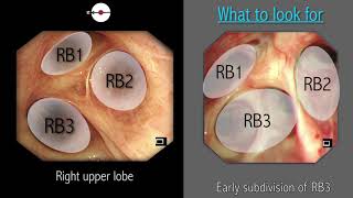 Nasal Nose Flush in a Cat [upl. by Bernard]