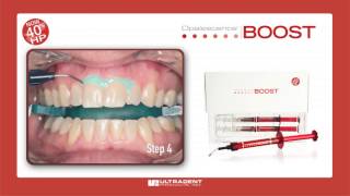 Ultradent Opalescence Boost Whitening [upl. by Elidad]