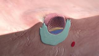 Implantation of the blastocyst [upl. by Maupin]