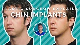 CHIN IMPLANTS EXPLAINED experience results recovery chin filler [upl. by Baugh763]