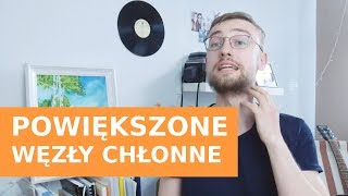 POWIĘKSZONE WĘZŁY CHŁONNE Kiedy mogą być nowotworowe Onkologia Kliniczna [upl. by Kelcie603]