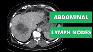 Abdominal CT Lymph Node Stations  How to read a CT [upl. by Nicolea]