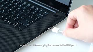 How to use Anykit NTE430 USB Ear Wax Camera with Windows PC [upl. by Ahsote]