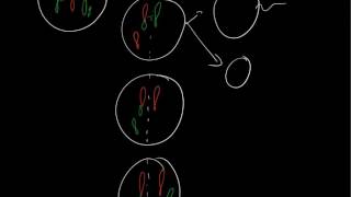 Robertsonian translocation 21q14q [upl. by Phila]