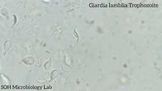 Giardia lamblia Trophozoite in stool [upl. by Hodge]