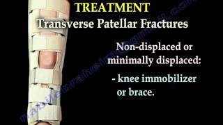 Patellar Fractures  Everything You Need To Know  Dr Nabil Ebraheim [upl. by Omlesna]