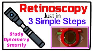 Retinoscopy in 3 Simple Steps [upl. by Lauryn]